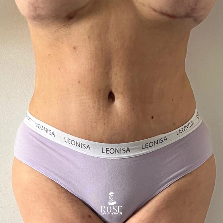 After image